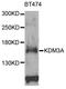 Lysine-specific demethylase 3A antibody, STJ24301, St John