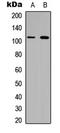 Collagen Type VI Alpha 1 Chain antibody, LS-C354629, Lifespan Biosciences, Western Blot image 