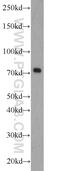 Zinc Finger And BTB Domain Containing 20 antibody, 23987-1-AP, Proteintech Group, Western Blot image 