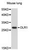 Oxidized Low Density Lipoprotein Receptor 1 antibody, A12060, ABclonal Technology, Western Blot image 