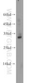 Baculoviral IAP Repeat Containing 8 antibody, 20144-1-AP, Proteintech Group, Western Blot image 
