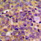 Protein Kinase CAMP-Dependent Type II Regulatory Subunit Beta antibody, LS-C352707, Lifespan Biosciences, Immunohistochemistry paraffin image 