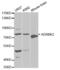 G Protein-Coupled Receptor Kinase 3 antibody, abx001666, Abbexa, Western Blot image 