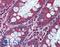 Activin A Receptor Type 1C antibody, LS-A7018, Lifespan Biosciences, Immunohistochemistry frozen image 