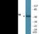 Protein Tyrosine Phosphatase Non-Receptor Type 1 antibody, EKC2208, Boster Biological Technology, Western Blot image 