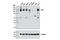 AXL Receptor Tyrosine Kinase antibody, 8661S, Cell Signaling Technology, Western Blot image 
