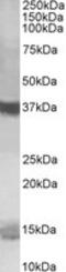 Prefoldin Subunit 1 antibody, MBS420458, MyBioSource, Western Blot image 