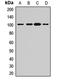 ADAM Metallopeptidase Domain 22 antibody, LS-C668673, Lifespan Biosciences, Western Blot image 