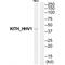 Thymidine kinase antibody, A30422, Boster Biological Technology, Western Blot image 