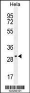 EMG1 N1-Specific Pseudouridine Methyltransferase antibody, 55-653, ProSci, Western Blot image 