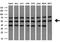 Nuclear Receptor Subfamily 1 Group H Member 3 antibody, M03331-1, Boster Biological Technology, Western Blot image 