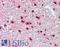 Carbonyl Reductase 3 antibody, LS-B3589, Lifespan Biosciences, Immunohistochemistry frozen image 