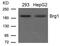 SWI/SNF Related, Matrix Associated, Actin Dependent Regulator Of Chromatin, Subfamily A, Member 4 antibody, GTX50842, GeneTex, Western Blot image 