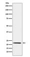 Peripheral Myelin Protein 22 antibody, M00890, Boster Biological Technology, Western Blot image 