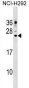 Cathelicidin Antimicrobial Peptide antibody, abx029196, Abbexa, Western Blot image 