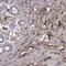 Lumican antibody, NBP1-87726, Novus Biologicals, Immunohistochemistry paraffin image 