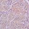 Protein Tyrosine Kinase 6 antibody, orb101306, Biorbyt, Immunohistochemistry paraffin image 