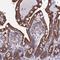 NADH:Ubiquinone Oxidoreductase Subunit A5 antibody, HPA043175, Atlas Antibodies, Immunohistochemistry paraffin image 