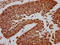 Centromere Protein A antibody, LS-C676836, Lifespan Biosciences, Immunohistochemistry paraffin image 