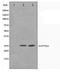 PTTG1 Regulator Of Sister Chromatid Separation, Securin antibody, TA347554, Origene, Western Blot image 