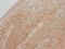 Cyclin Dependent Kinase 2 antibody, CSB-RA961467A0HU, Cusabio, Immunohistochemistry paraffin image 