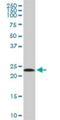 Mitochondrial Ribosomal Protein L11 antibody, H00065003-B01P, Novus Biologicals, Western Blot image 