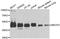 Methyl-CpG Binding Protein 2 antibody, STJ27661, St John