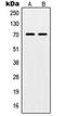 Protection Of Telomeres 1 antibody, orb215112, Biorbyt, Western Blot image 
