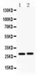 Insulin Like Growth Factor Binding Protein 1 antibody, PA5-79448, Invitrogen Antibodies, Western Blot image 