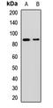 SEL1L Adaptor Subunit Of ERAD E3 Ubiquitin Ligase antibody, LS-C668390, Lifespan Biosciences, Western Blot image 