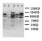 Desmoglein 2 antibody, LS-C312716, Lifespan Biosciences, Western Blot image 