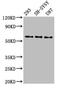 Nramp2 antibody, CSB-PA021381LA01HU, Cusabio, Western Blot image 