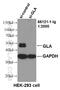 Galactosidase Alpha antibody, 66121-1-Ig, Proteintech Group, Western Blot image 