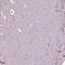 Sorcin antibody, HPA019004, Atlas Antibodies, Immunohistochemistry paraffin image 