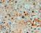 Triosephosphate Isomerase 1 antibody, 46-528, ProSci, Immunohistochemistry paraffin image 