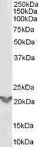 TGFB Induced Factor Homeobox 2 antibody, LS-B11170, Lifespan Biosciences, Western Blot image 