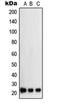 Suppressor Of Cytokine Signaling 2 antibody, orb214835, Biorbyt, Western Blot image 