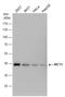 Solute Carrier Family 16 Member 1 antibody, NBP2-43838, Novus Biologicals, Western Blot image 