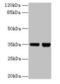Zinc Finger BED-Type Containing 1 antibody, CSB-PA02715A0Rb, Cusabio, Western Blot image 