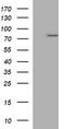 Tumor Protein P73 antibody, TA506453, Origene, Western Blot image 