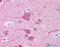 TOR antibody, ARP59155_P050, Aviva Systems Biology, Immunohistochemistry frozen image 