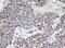 WD Repeat Domain 74 antibody, NBP2-45420, Novus Biologicals, Immunohistochemistry paraffin image 