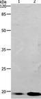 Baculoviral IAP Repeat Containing 5 antibody, TA323464, Origene, Western Blot image 