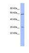 Histidine Rich Glycoprotein antibody, NBP1-80491, Novus Biologicals, Western Blot image 