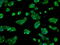 Fyn Related Src Family Tyrosine Kinase antibody, GTX84484, GeneTex, Immunofluorescence image 
