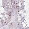 Transmembrane Protein 237 antibody, NBP2-33731, Novus Biologicals, Immunohistochemistry paraffin image 