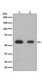 SMAD Family Member 3 antibody, M00059, Boster Biological Technology, Western Blot image 