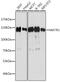 Matrin 3 antibody, GTX66470, GeneTex, Western Blot image 
