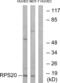 40S ribosomal protein S20 antibody, abx014099, Abbexa, Western Blot image 