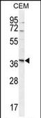 Neurexophilin 4 antibody, PA5-71484, Invitrogen Antibodies, Western Blot image 